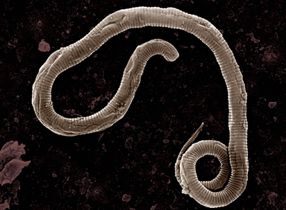 Where do worms come from in the human body
